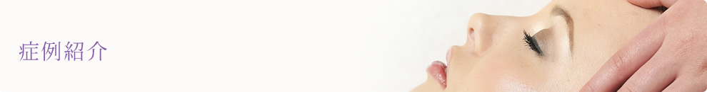 フェイスライン・あご・小顔・輪郭