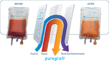 ピュアグラフト