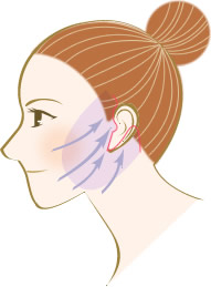 フェイスリフト